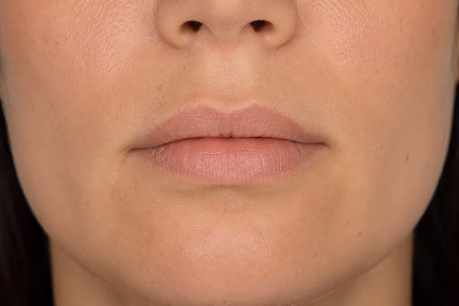 Después del tratamiento facial