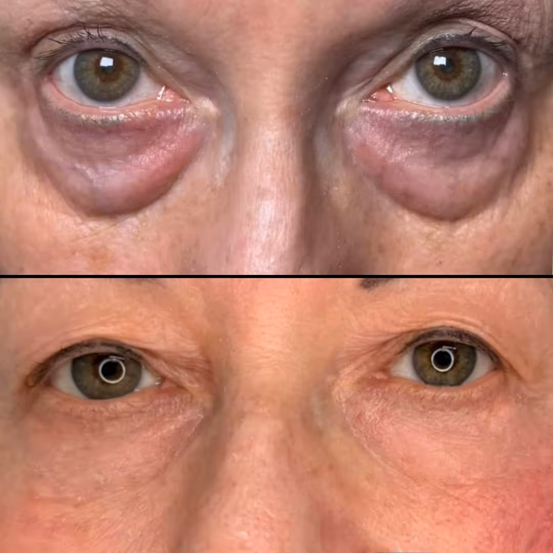 Caso ilustrativo de evolución facial antes y después del tratamiento