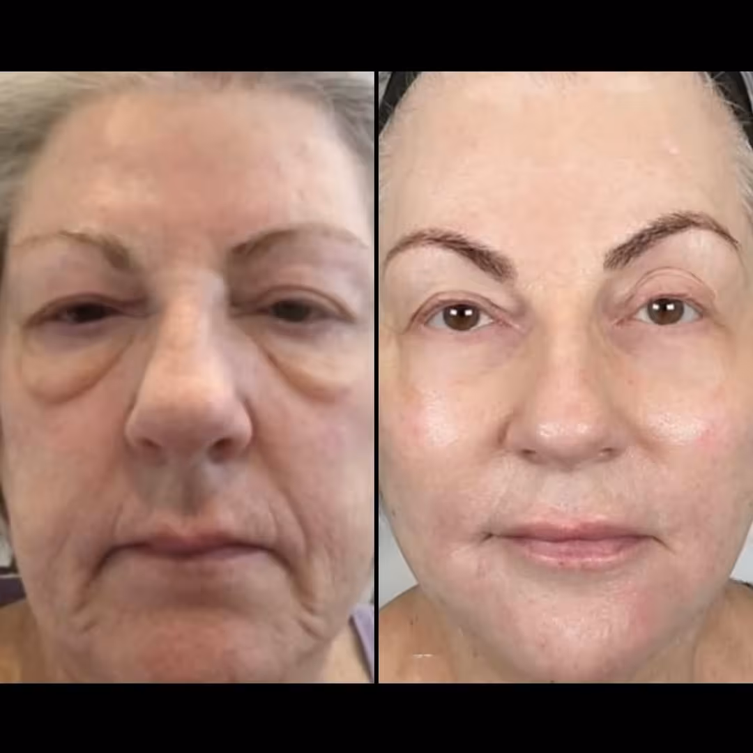 Caso ilustrativo de evolución facial antes y después del tratamiento