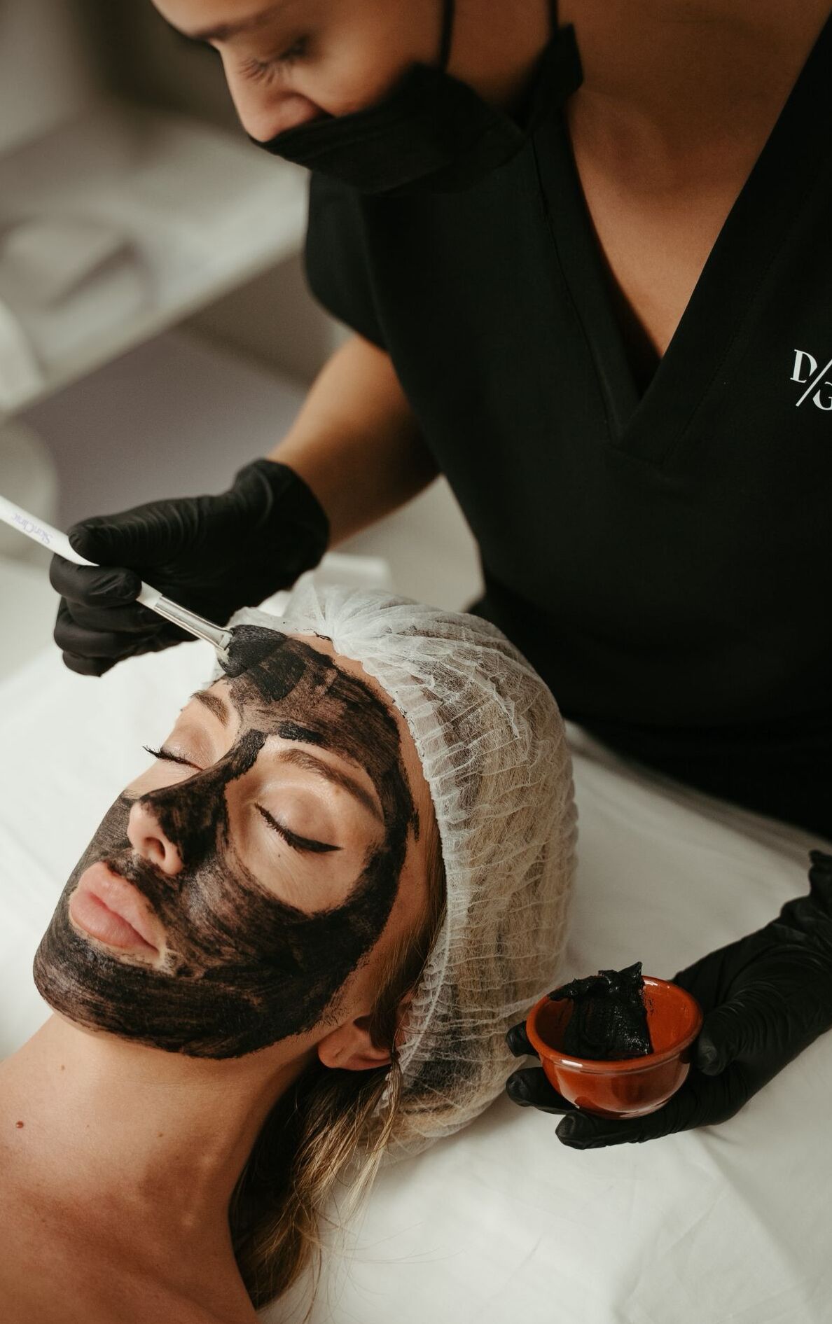 Hollywood Peel en consulta
