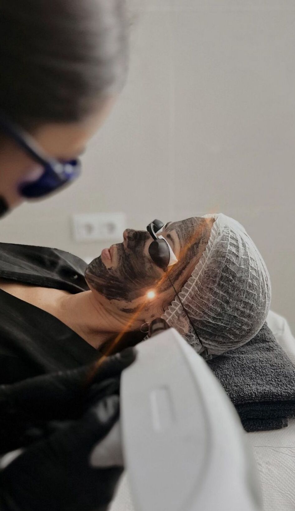 Procedimiento Hollywood Peel