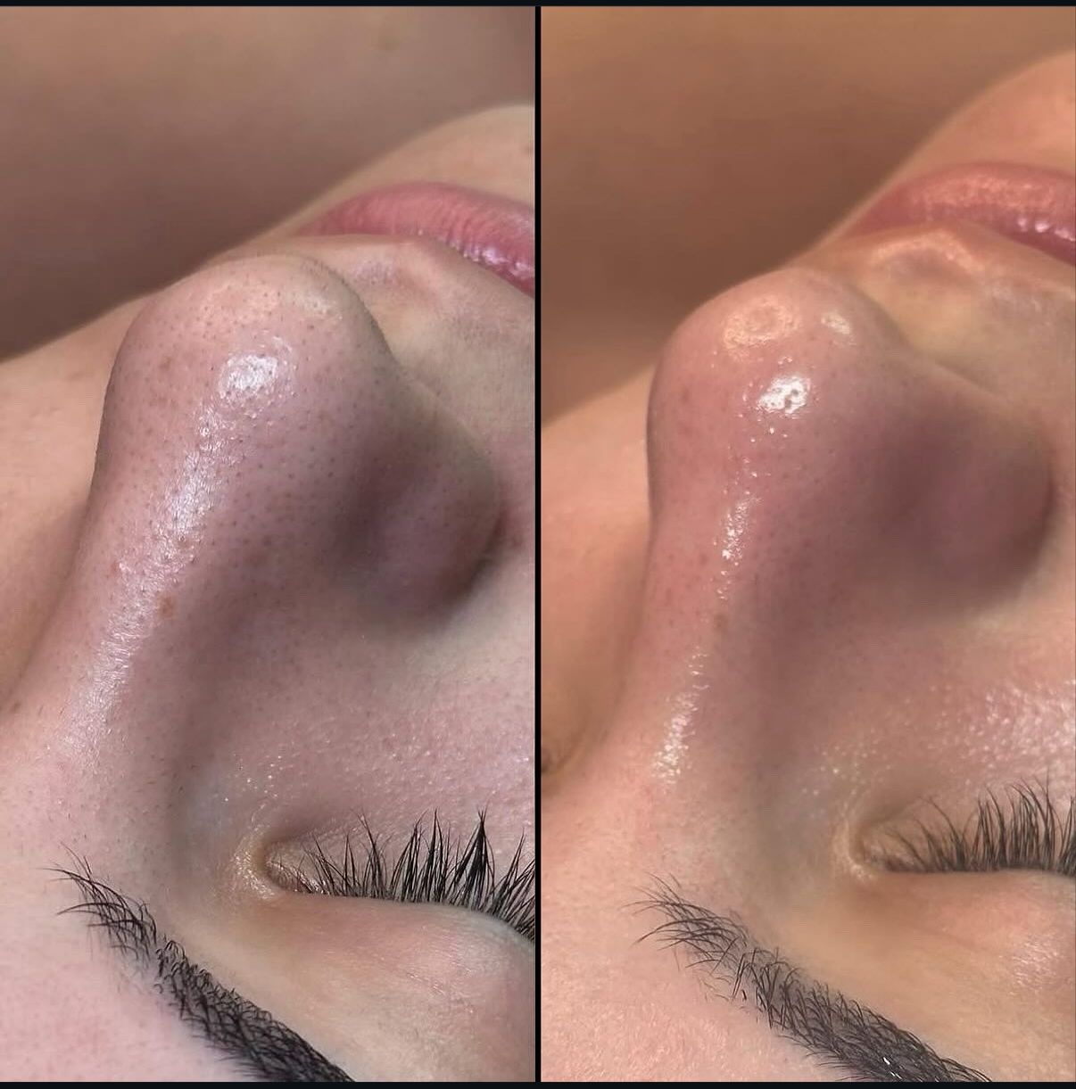 Caso ilustrativo de evolución facial antes y después del tratamiento