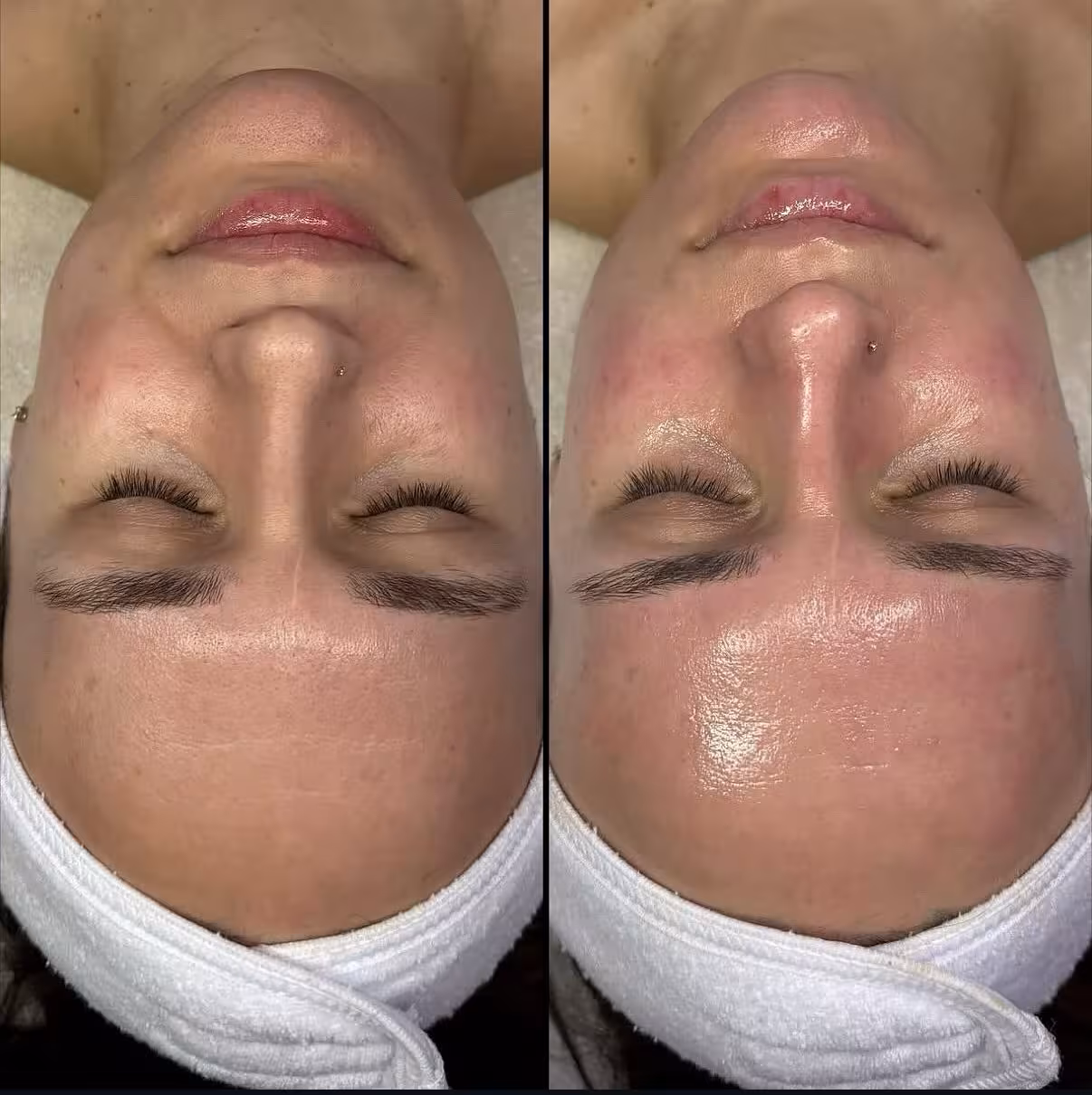 Caso ilustrativo de evolución facial antes y después del tratamiento