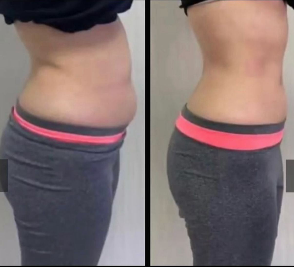 Antes y después de Wonder Axon