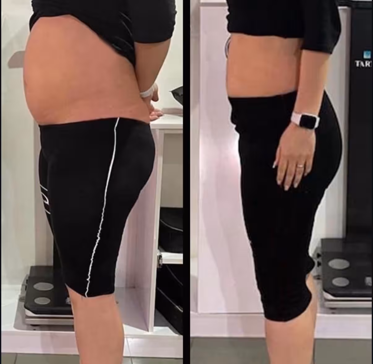 Antes y después de Wonder Axon en otra vista