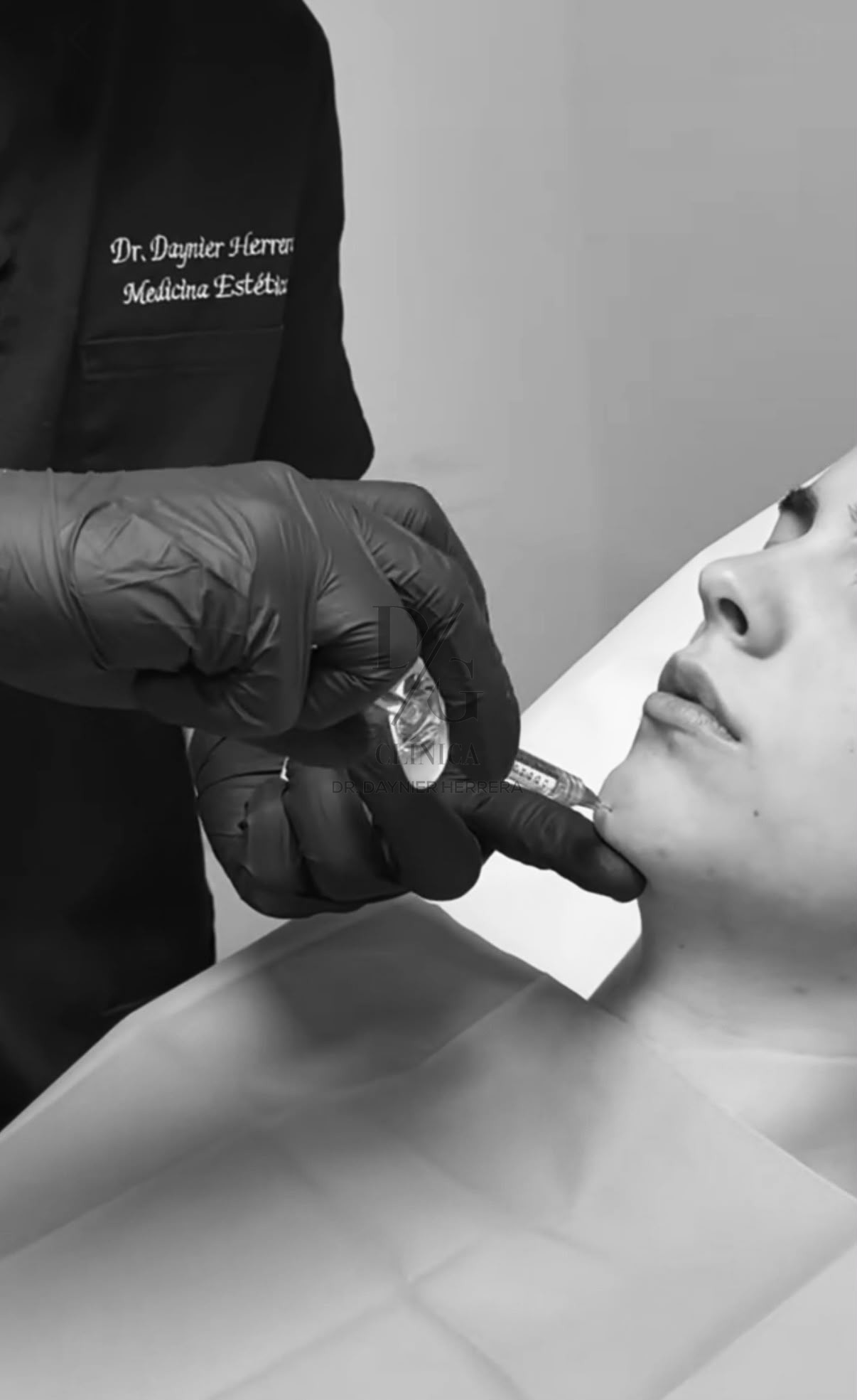 Aplicación de tratamiento de armonización facial