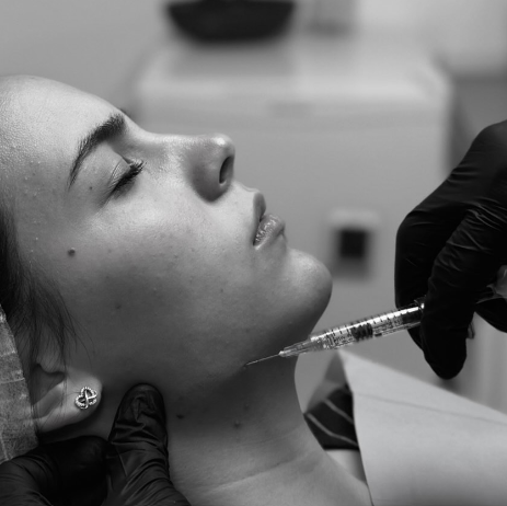 Tratamiento de marcación mandibular en clínica