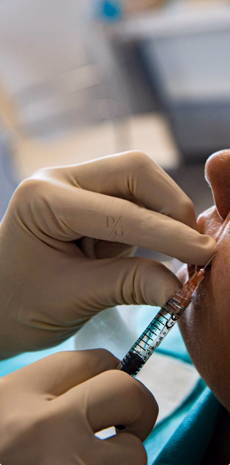 Tratamiento de ojeras en clínica